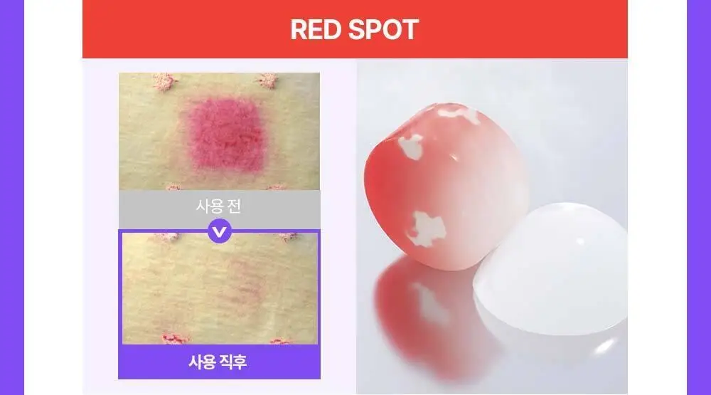 [잡티케어] 더마펌 수딩 리페어 토닝 세럼 R4 30ml 기획 (+리필 30ml) 상세페이지 23